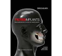 Tilted implants. Riabilitazione implanto-protesica del paziente atrofico