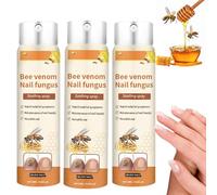 Timilk Fungibee Advanced Nail Repair Spray - Bee Venom Nail Spray, Nail Repair Treatment for Weak and Damaged Nail, Reveal Healthier Nails in Just 21 Days (3)