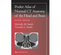 Timothy L. Smith Michel Pocket Atlas of Normal CT Anatomy of the Hea (Tascabile)