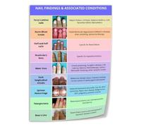 Toenail Problems Poster Fungal Infection Chart for Pedicure Station