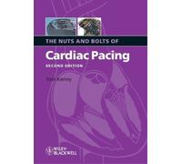 Tom Kenny The Nuts and Bolts of Cardiac Pacing (Tascabile)