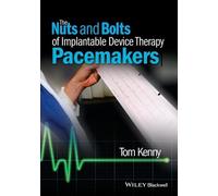 Tom Kenny The Nuts and Bolts of Implantable Device Therapy (Tascabile)