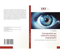 Tomographie par cohérence optique angiographie: dans les pathologies chorioretinnes vasculaires
