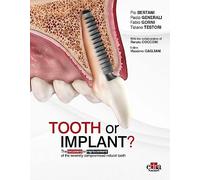 Tooth or Implant? The recovery or replacement of the severely compormised natural tooth
