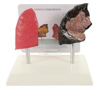 TOPBATHY Anatomico Polmonare Da 1 Pezzo Confronto Tra Polmoni Fumatori Per L'Insegnamento E L'Educazione Medica Caratteristiche Patologiche Realistiche Per La Formazione In