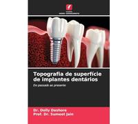 Topografia de superfície de implantes dentários: Do passado ao presente