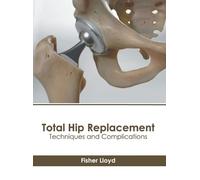 Total Hip Replacement: Techniques and Complications (Copertina rigida)