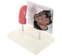 Toyvian Modello Anatomico Polmonare Realistico Confronto Polmoni Sani e Fumatori in Pvc Modello Didattico per Insegnamento di Anatomia e Fisiologia per Studenti
