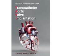 Transcatheter aortic valve implantation