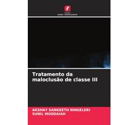 Tratamento da maloclusão de classe III