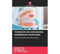 Tratamento de instrumentos endodônticos fracturados: Gestão de instrumentos endodônticos separados
