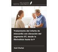 Tratamiento del infarto de miocardio con elevación del segmento ST, desde la fibrinólisis hasta la P
