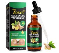 Trattamento delle unghie, trattamento fungino del chiodo dello zenzero per le unghie delle mani e dei piedi