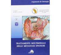 Trattamento multimodale delle metastasi epatiche