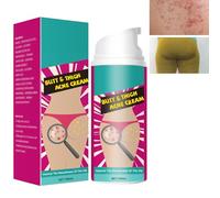 Trattamento Per L'acne Sui Glutei,Crema Per L'acne Dell'anca,Elimina Acne,Applicabile Glutei E Cosce,100ML