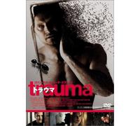 Trauma [04/E, J/Dd/S: J]