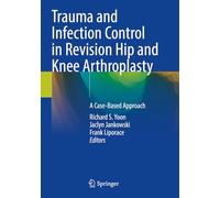 Trauma and Infection Control in Revision Hip and Knee Arthroplasty: A Case-Based Approach