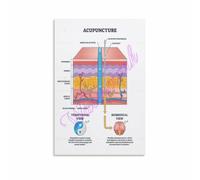 Trigger Point Poster for Therapist Bodywork Studio | Cross reference acupuncture meridians with myofascial trigger points for integrated treatments(Framed,16x24inch(40x60cm))