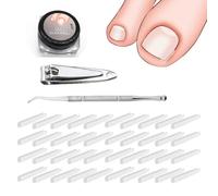 TSUOUKL Set correttore per unghie incarnite 40pcs Strisce raddrizzanti per unghie incarnite senza dolore con sollevatore per unghie - Kit di strumenti unghie incarnite facili usare +tagliaunghie