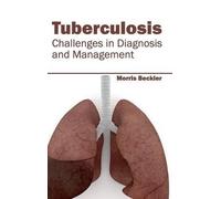 Tuberculosis: Challenges in Diagnosis and Management (Copertina rigida)