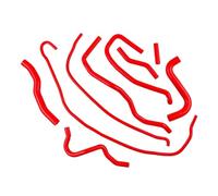 Tubo Ingresso Dell'aria 9 PCS Per 2006 2007 2008 Per Ford Per Fiesta Mk6 ST 150 2.0 Per Duratec ST Motore Silicone Kit Tubo Flessibile Liquido Raffreddamento Linea Aspirazione(Rosso)