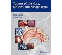 Tumors of the Nose, Sinuses and Nasopharynx