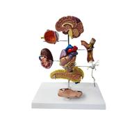 Type Ii Diabetes Model Set, for Human Anatomy and Physiology Education, Anatomical Models for Doctor'S Office