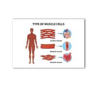 Types Of Muscle Tissue Chart Poster Skeletal Voluntary Striated Cardiac Involuntary Branched Smooth Non Striated Visceral Biology Classroom Wall-Art For Science Room(Framed,08x12inch(20x30cm))