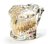 Uadme Modello Denti Dimostrativo, Modello Denti Estraibili Trasparente, Modelli di Insegnamento Dentale, per Studenti, Istruzione e Pratica
