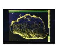 UFO Hunters: Abductions