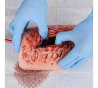 UIGJIOG L'addestratore Pacchetti Ferite alla Coscia Simula L'avvolgimento Ferite E L'uso Lacci Emostatici L'addestratore Lacci Emostatici Il Controllo Sangue Stop Bleed Training Corsi Medicina