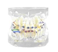 UIGJIOG Modello dei Denti Modello Ortodontico Trasparente Modello Dimostrazione Ortodonzia Dentale Modello Visualizzazione Ortodonzia mit Bretelle per Insegnare O Comunicare con I Pazienti