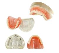 UIGJIOG Modello Dentale della mascella Superiore Deck Denture Inferiore 2 Impianti Modello dimostrativo per la Formazione e Lo Studio