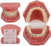 UIGJIOG Modello di ortodonzia Dentale,Modello Dentale ortodontico in Resina,Modello dimostrativo di ortodonzia Dentale Modello Dentale con Staffa in Fili Metallici per l'insegnamento