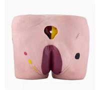 Ulcere Da Pressione Modello Infermieristico, Modello Di Cura Bedulcer Per Anziani, 4 Fasi Di Ulcere Da Decubito Ulcera, Valutare E Misurare La Ferita, Per L'esercizio Infermieristico Di Base