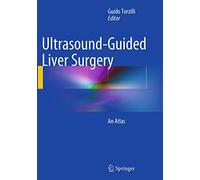 Ultrasound-Guided Liver Surgery: An Atlas