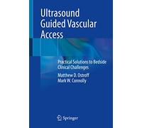 Ultrasound Guided Vascular Access: Practical Solutions to Bedside Clinical Challenges
