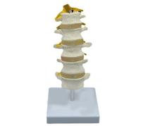 Umana Anatomico Lombare Spina Modello Pathological Anatomia Modello