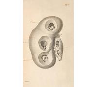 Un saggio sulla storia chimica e il trattamento medico dei disturbi calcolari Pl.7 (1819) Stampa poster di Alexander Marcet (18 x 24)