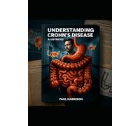 Understanding Crohn's Disease. Illustrated