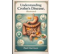 Understanding Crohn's Disease. Illustrated