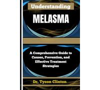UNDERSTANDING MELASMA: A Comprehensive Guide to Causes, Prevention, and Effective Treatment Strategies