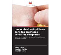 Une occlusion équilibrée dans les prothèses dentaires complètes: La science de l'équilibre fonctionnel occlusal dans la prothèse complète
