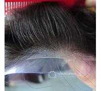 Uomo Naturale Sottile Pelle Capelli Sostituzione Sistema Toupet Parrucchino #1B