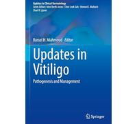 Updates in Vitiligo: Pathogenesis and Management