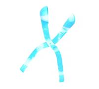 UPKOCH Clip per Palle di Neve in Plastica Sicura Strumento Interattivo per Giochi Invernali all Manico Ergonomico per Utensile Divertente per Battaglie sulla Neve Colore Colore Casuale