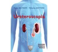 Ureteroscopia