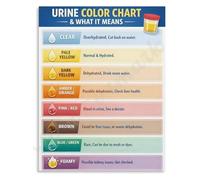 Urine Color Chart Poster What It Means Health Education Guide | Simple visual reference for monitoring daily wellness(Unframed,08x12inch(20x30cm))