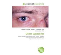 Usher Syndrome: Genetic disorder, Deafblindness, Gene therapy, Deafness, Inner ear, Retinitis pigmentosa, Rod cell, Night blindness, Peripheral vision