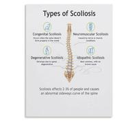 UYCUODLUY Right Left Thoracic Scoliosis Poster Lumbar Curve Identification Chart Student Study Wall-Art Print(Unframed,16x24inch(40x60cm))